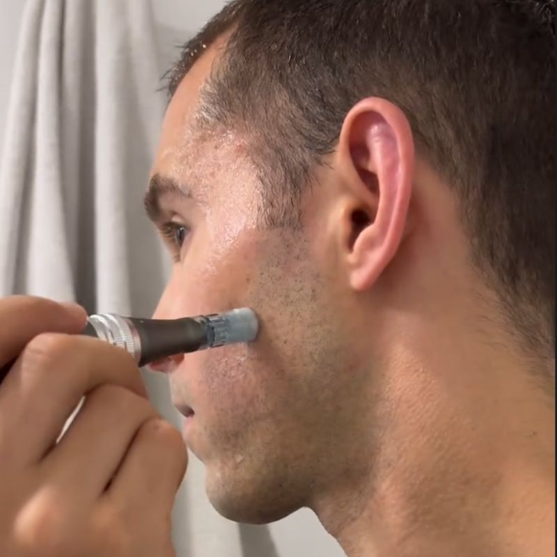 Dr. Pen Ultima M8 Microneedling Pen