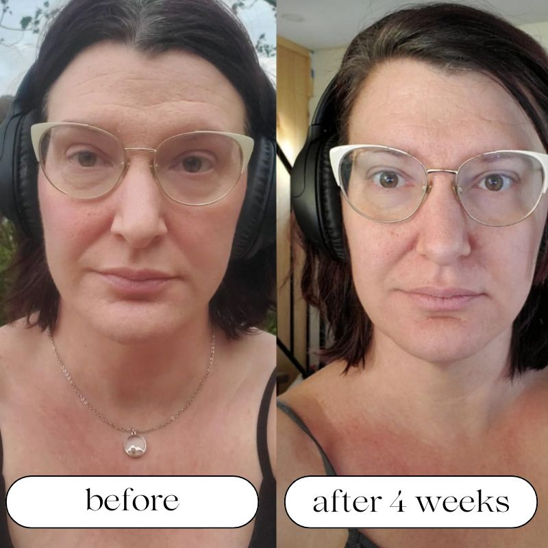 FDA Approved LED Light Therapy Machine