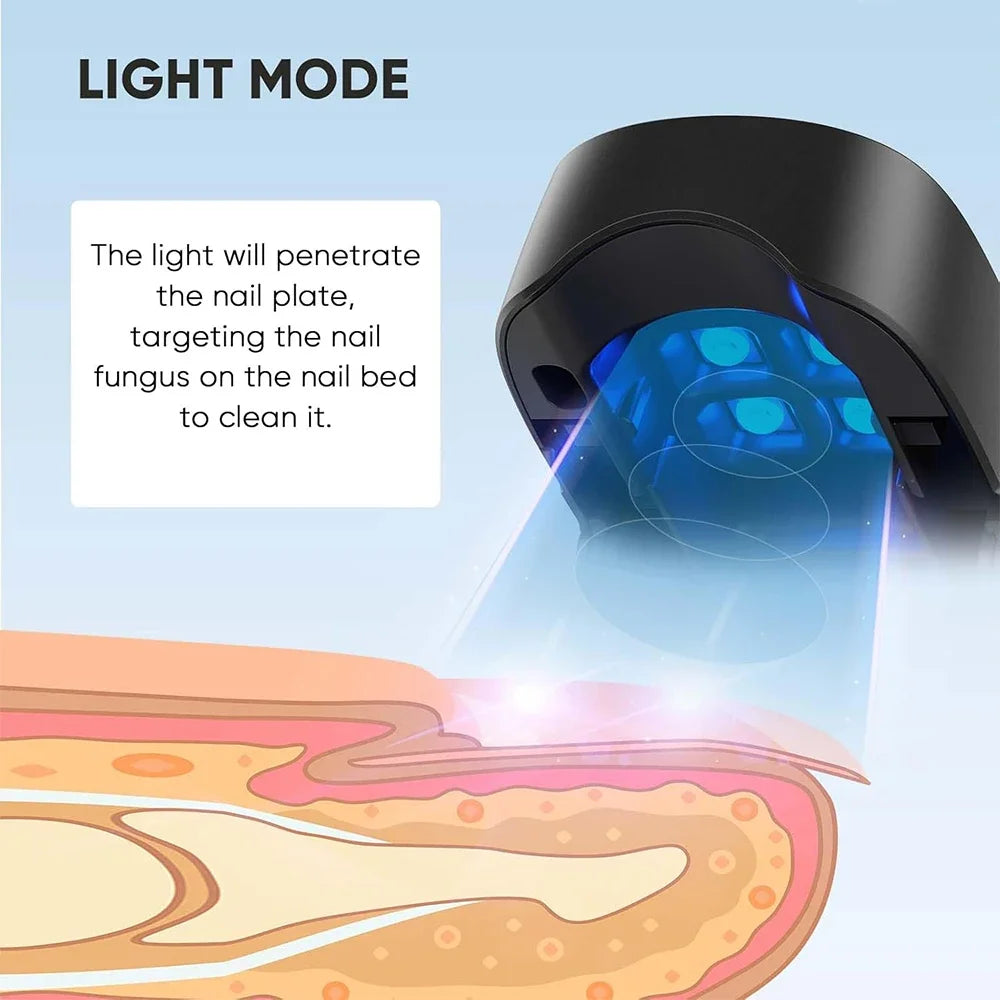 Laser Treatment Device for Nail Fungus and Onychomycosis